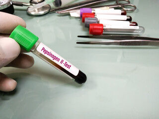 Blood sample tube for Pepsinogen I test. To diagnosis Gastric cancer with medical laboratory...