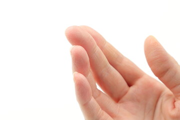 冬の手荒れ © bonbon