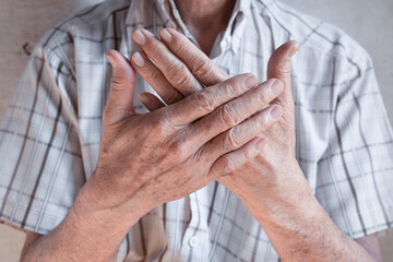 Asian Myanmar elder man’s hands. Concept of rheumatoid arthritis or joint pain.