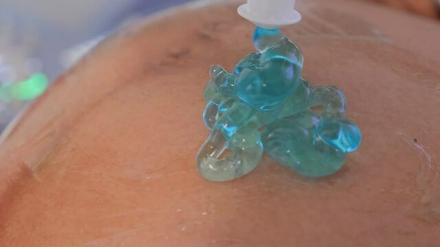 Ultrasound pregnant transducer blue gel pregnancy tummy ultrasonic scanner close-up conductive gel 5D ultrasound