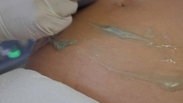 Ultrasound pregnant transducer blue gel pregnancy tummy ultrasonic scanner close-up conductive gel 5D ultrasound