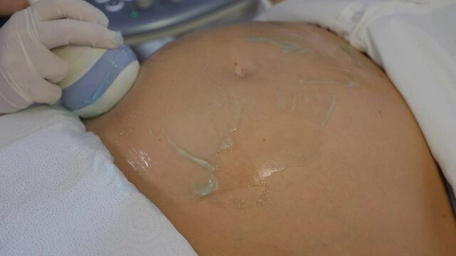 Ultrasound pregnant transducer blue gel pregnancy tummy ultrasonic scanner close-up conductive gel 5D ultrasound