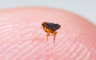 Flea on human skin close up. Extermination of parasites, insecticides, house disinfection.