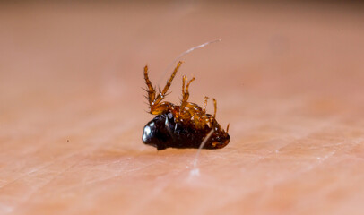 Flea on human skin close up. Extermination of parasites, insecticides, house disinfection.