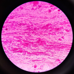 Gram staining, also called Gram's method, is a method of differentiating bacterial species into two large groups (Gram-positive and Gram-negative).