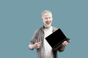 Excited albino guy pointing at laptop computer with black blank screen on turquoise studio background, mockup