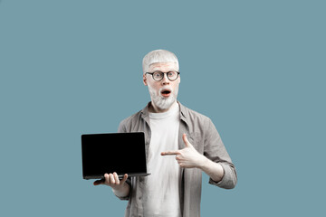 Great website advertisement. Surprised albino man showing laptop empty screen, pointing on it over turquoise background