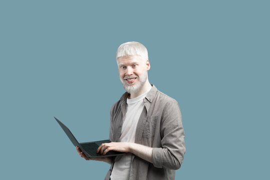 Modern technologies. Happy albino guy using laptop computer over turquoise background, enjoying remote job offers