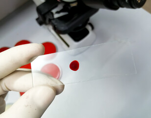 Hand of scientist hold glass slide with a drop of blood for further laboratorical testing.