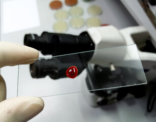 Hand of scientist hold glass slide with a drop of blood for further laboratorical testing.