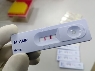 Rapid screening test for Amphetamine (AMP) test. Diagnosis of illegal drug Amphetamine.
