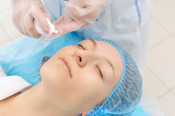 Closeup of a young woman face in a beauty salon. The use of cotton pads in the preparation of facial skin for rejuvenation and moisturizing procedures