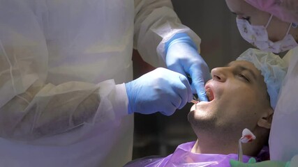 Two doctors in gloves install a dental implant.Restoration of missing teeth with an implant.Installation of veneers in modern dentistry for a young man.The concept of dentistry and dental care.Closeup