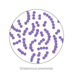 Streptococcus pneumoniae, pathogenic bacteria. Bacterial microorganism. Microbiology, infographic - 476868211