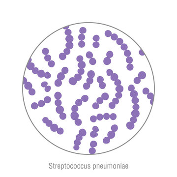 Streptococcus pneumoniae, pathogenic bacteria. Bacterial microorganism. Microbiology, infographic