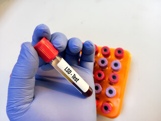 Blood sample tube for LSD test. doping drugs test at medical laboratory.