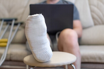 A man sits on a sofa in a cast with a laptop. A leg in a cast lies on a chair.