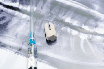 Toy tooth model, syringe with anesthetic and teeth x-ray image close up.