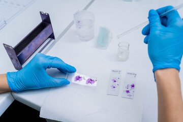 Fototapeta premium Hands in blue glove holding glass histology slides