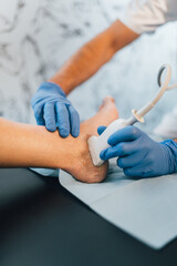 Close-up of a Chiropodist doing an ultrasound test to patient's foot.