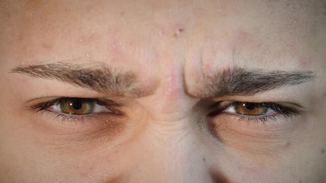 Macro close up of angry man's face with hazel eyes and acne skin condition. Young Arab male model with different eye colors looking aggressive and disgusted at camera. Slow-motion, 4K.