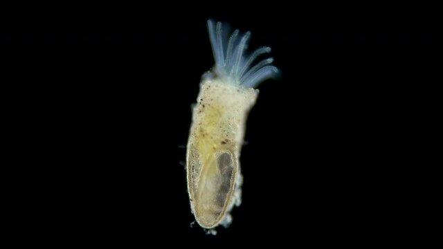 Freshwater bryozoans under microscope, Class Phylactolaemata, Order Plumatellida. Filter feeders. Similar to worms in Sabellida family