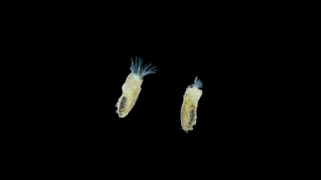 Freshwater bryozoans under microscope, Class Phylactolaemata, Order Plumatellida. Filter feeders. Similar to worms in Sabellida family