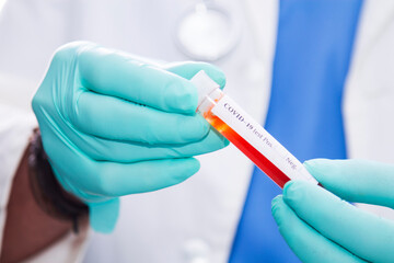 Test tube with blood sample in doctor hand. Covid-19 coronavirus diagnostic