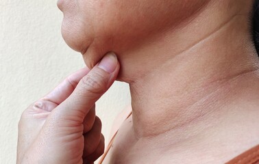 close up of a woman squeezing sagging skin under the neck.