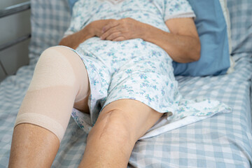 Obraz na płótnie Canvas Asian senior or elderly old lady woman patient with knee support pain joint on bed in nursing hospital ward, healthy strong medical concept.