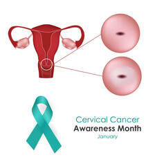 January is a month of cervical cancer awareness. Vector