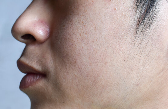 Fair skin with wide pores in hairy face of Asian, Myanmar or Korean man.