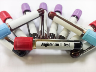Blood sample for Angiotensin II test. To diagnosis and monitor sarcoidosis at medical laboratory. Test tube background