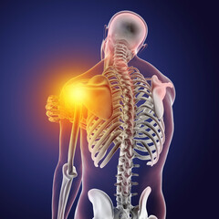 Shoulder pain, 3D illustration