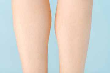 Women's legs with a lot of hair before epilation, close-up