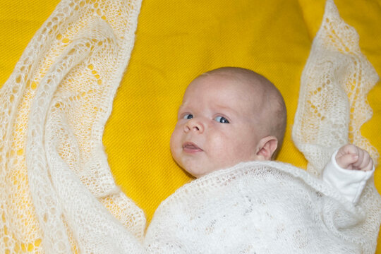 Newborn baby with acne and pimples on a yellow and gray background. A photo shoot in the style of Newborn and lifestyle. eczema and atopic dermatitis