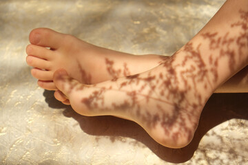 Fototapeta na wymiar Close up bare foot in the morning with floral shadows, relaxing. Lying and enjoying rest.