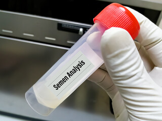 Semen in a pot for analysis at the doctor's hand. Human fertility diagnosis sperms count...