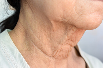 Aging skin folds or skin creases or wrinkles at neck of Asian old woman.