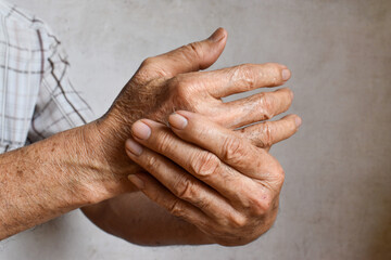 Fototapeta premium Asian man’s fingers and hand. Concept of hand pain, arthritis and finger problems.