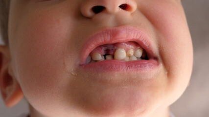 Little boy showing his teeth