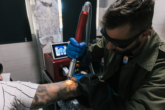 Master making laser tattoo on hand of man