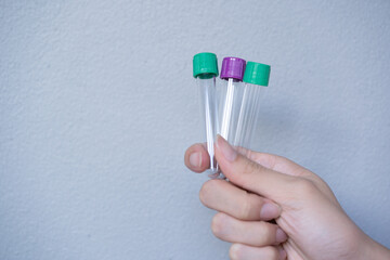 Tube Ready-to-use blood collection 