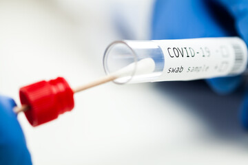 Close up of COVID-19 PCR testing collection kit