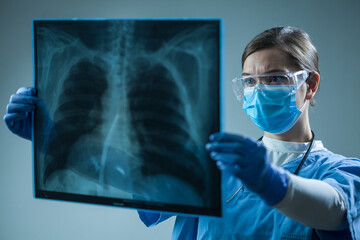 Female doctor looking at X-Ray radiography scan in patient room