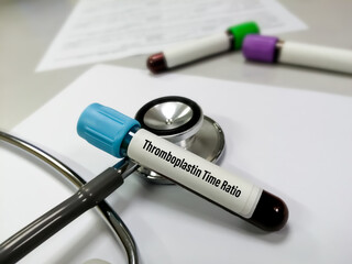 Blood sample tube for Thromboplastin Time Ratio test at medical laboratory.