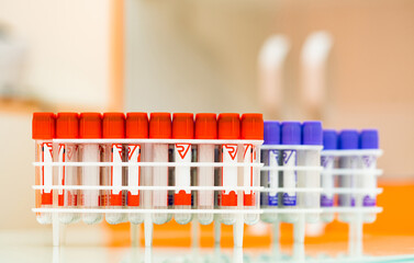 Healthcare medicine concept. Close up view of blood test procedure in laboratory.