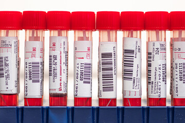Real series of molecular PCR tests, nasal and oropharyngeal swabs with red reagent in vials,...