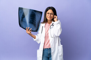 Young doctor woman holding a radiography frustrated and covering ears