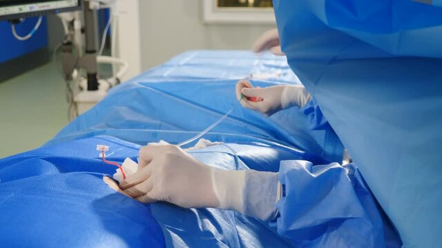Vascular surgery. Hands of radiologist performing endovascular operation with angiography machine. Doctor using contrast liquid for uterine fibroid embolization. Cardio-vascular examination. getting